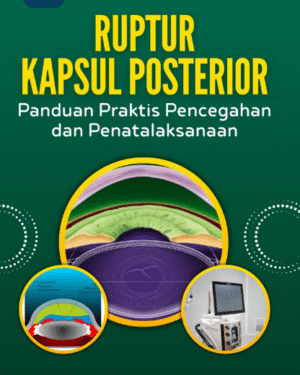 RUPTUR KAPSUL POSTERIOR PANDUAN PRAKTIS PENCEGAHAN DAN PENATALAKSANAAN