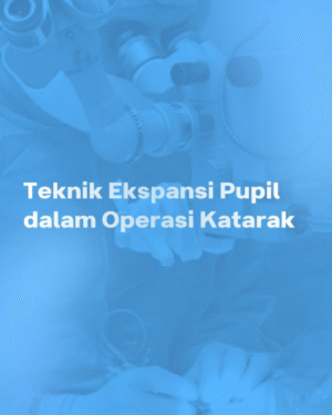 TEKNIK EKSPANSI PUPIL DALAM OPERASI KATARAK