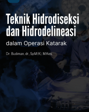 TEKNIK HIDRODISEKSI DAN HIDRODELINEASI DALAM OPERASI KATARAK